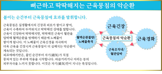 뻐근하고 딱딱해지는 근육뭉침의 악순환