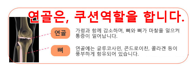 I형콜라겐+MSM글루코사민+콘드로이틴+금시생강(제법특허제품)